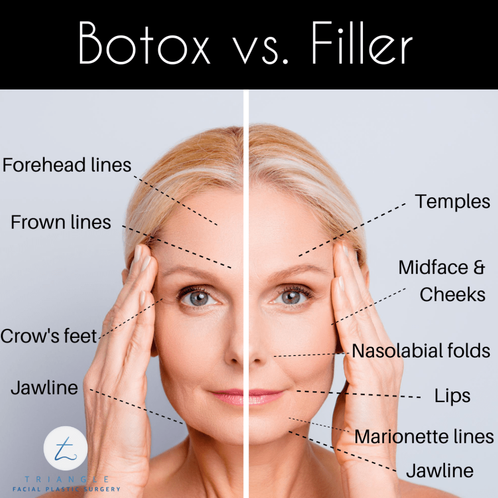 Botox vs. Filler: What’s the Difference?