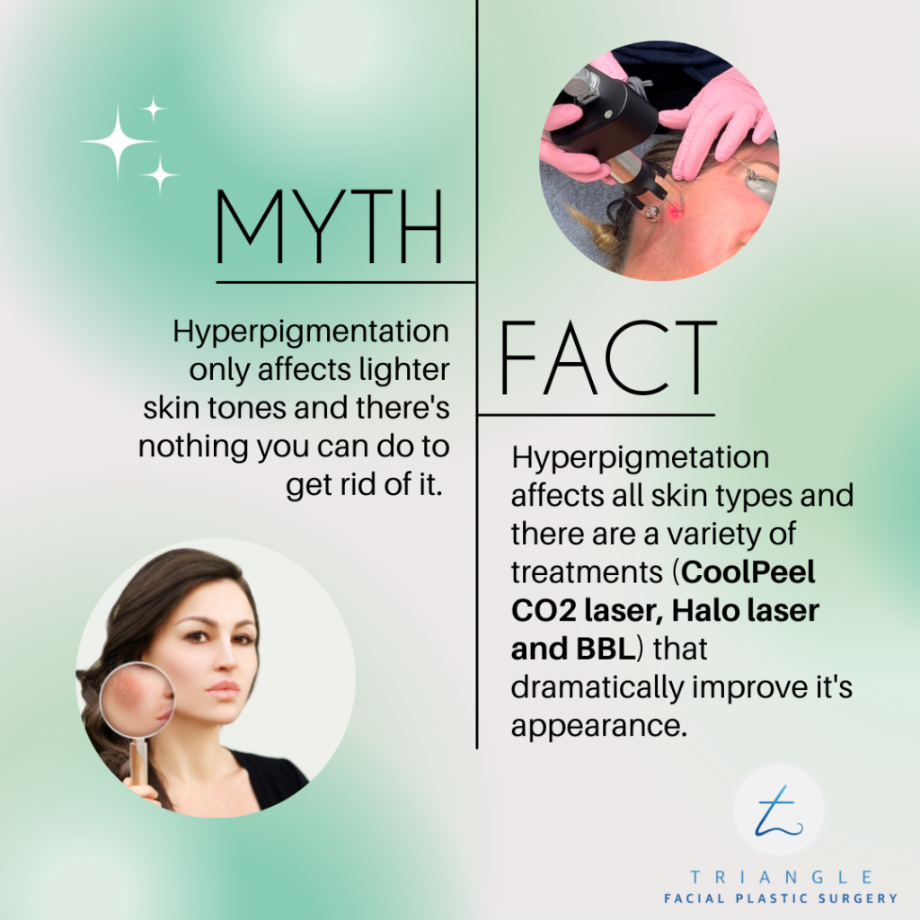 Hyperpigmentation Myth or Fact?