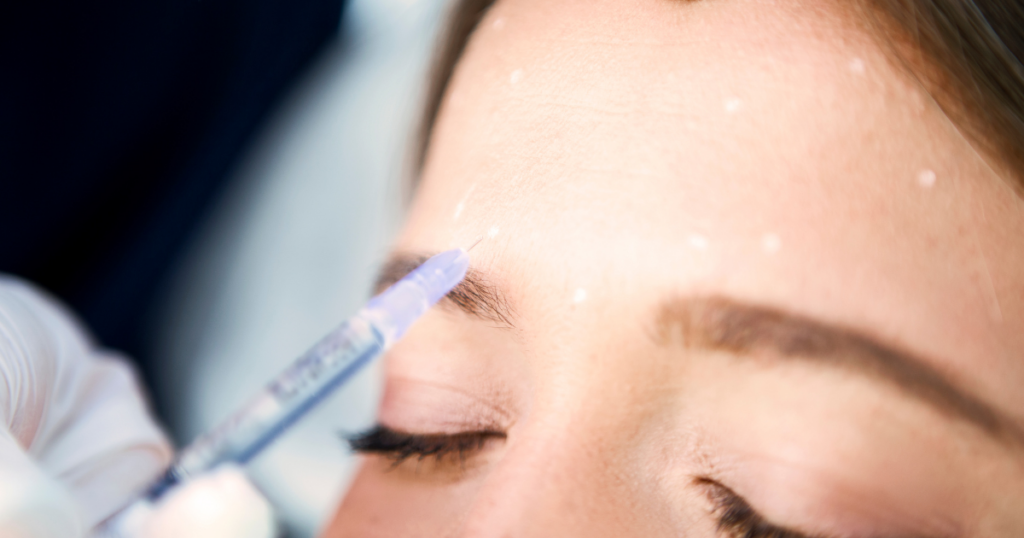 The Aesthetic Benefits of Botox Injections