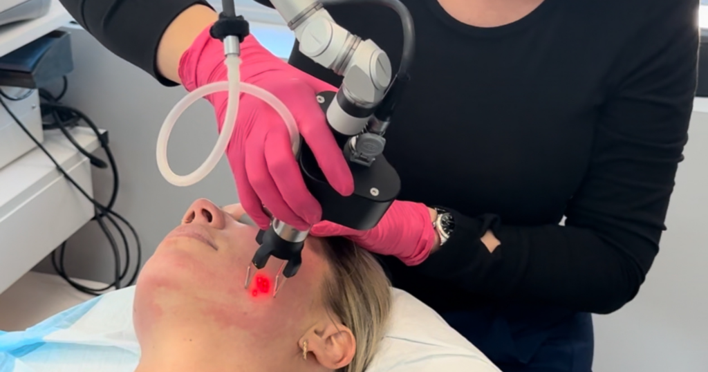 Revitalize Your Skin This Fall – The Best Rejuvenating Skincare Treatments