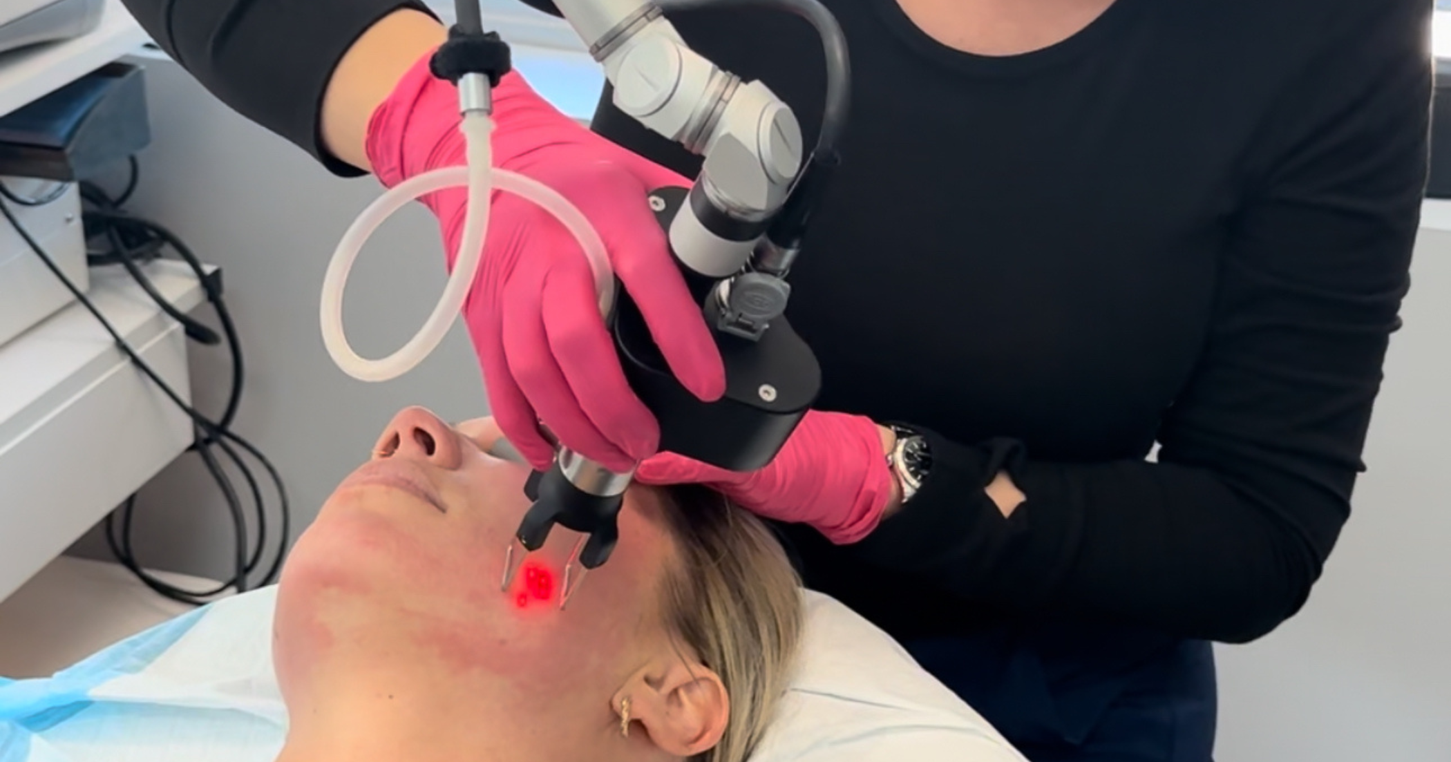 Laser Skin Treatment Raleigh Revitalize Your Skin This Fall