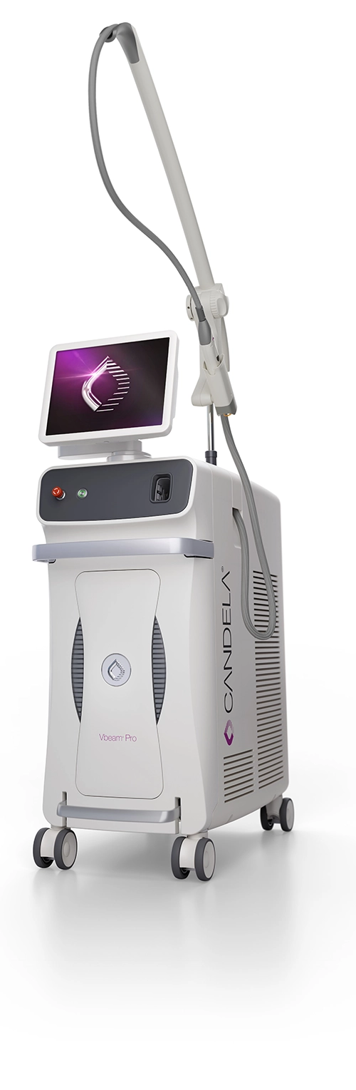 Vbeam® Pro Laser Vbeam® Pro Laser